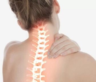 Dzemdes kakla osteohondroze