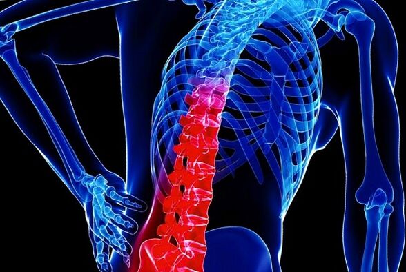 Krūškurvja osteohondrozes attīstības iemesli