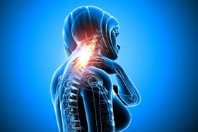 osteohondroze mugurkaula kakla daļā