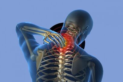 sāpes kaklā ar osteohondrozi